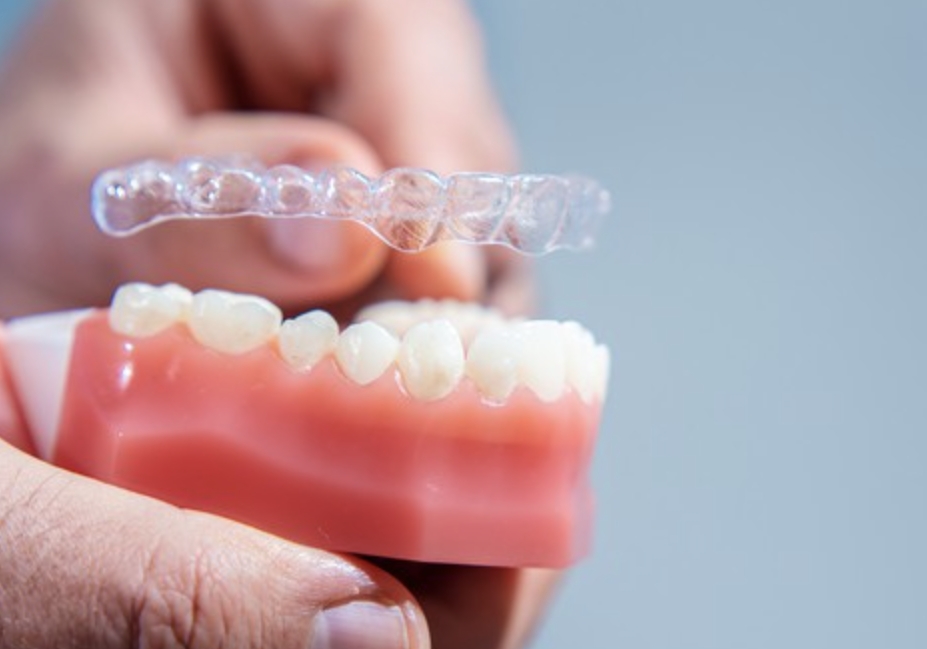 Custom made clear aligners