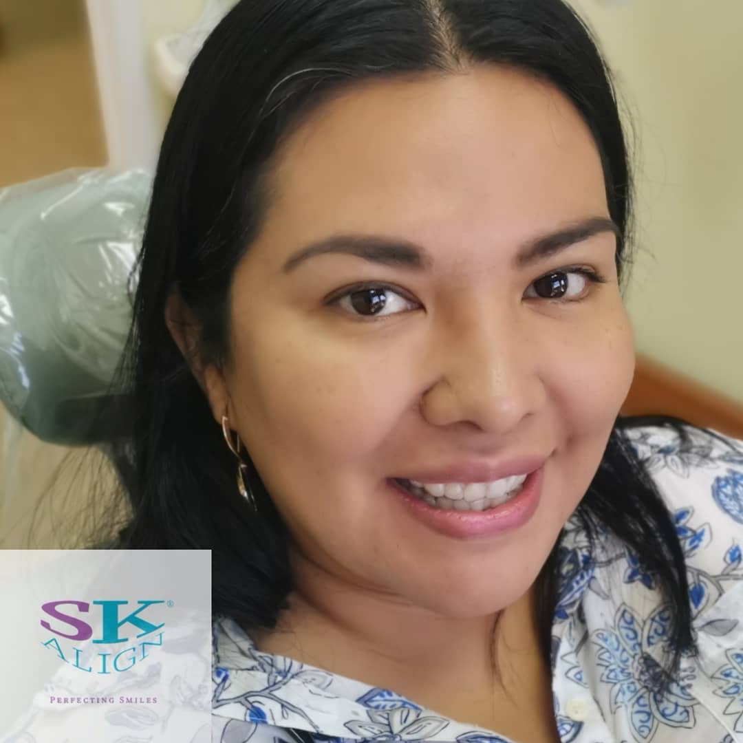 Clear aligner treatment progress